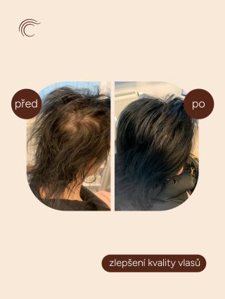 Řídnoucí nebo oslabené vlasy nejsou pouze kosmetický problém. Ovlivňují to, jak se cítíme, když se podíváme do zrcadla. V...